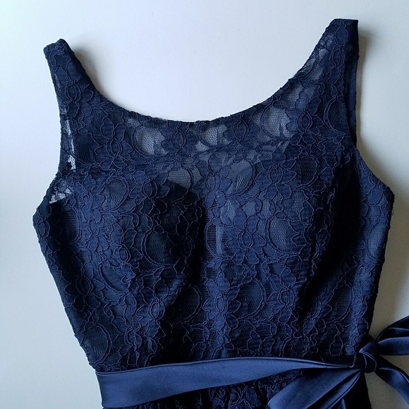 Blue Lace Dress - Picture 2 of 7